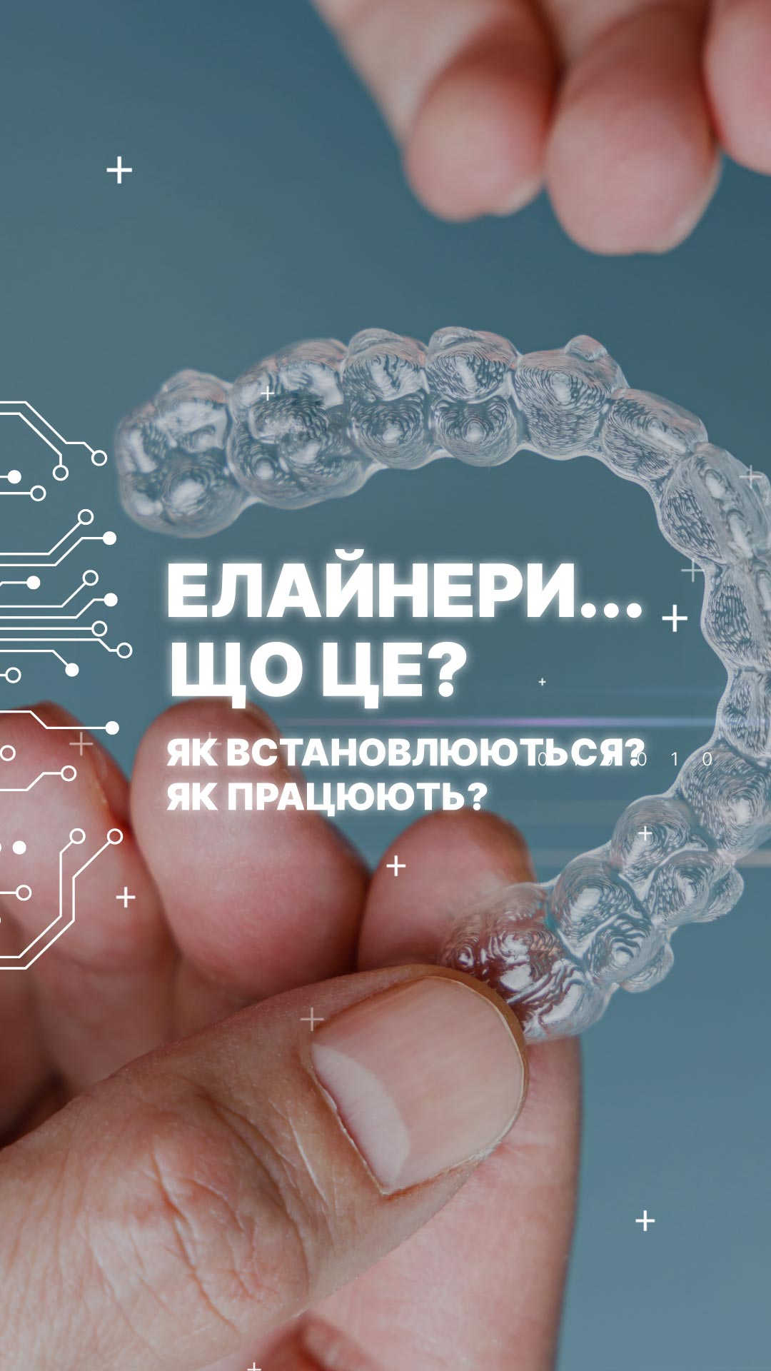 Фото: Вирівнювання зубів елайнерами Invisalign № 21 | Nozenko